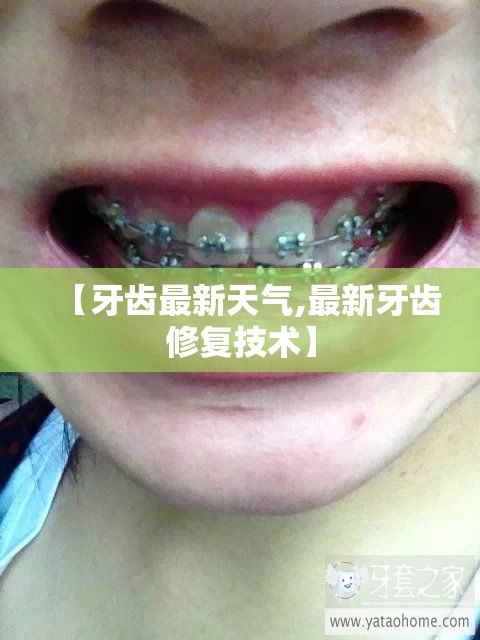 【牙齿最新天气,最新牙齿修复技术】
