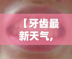 【牙齿最新天气,最新牙齿修复技术】
